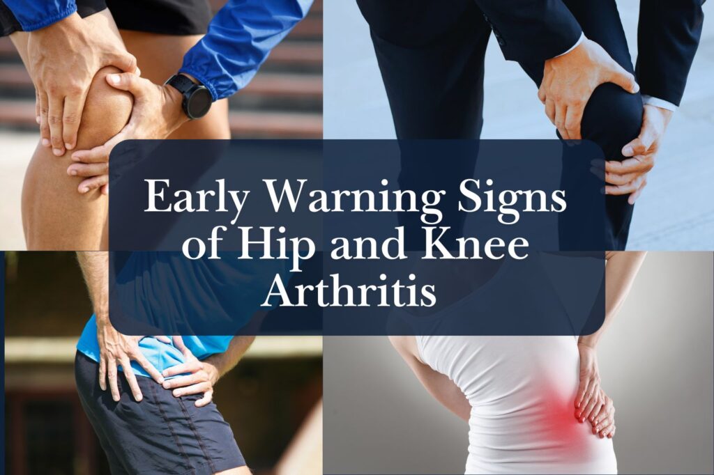 Early Warning Signs of Hip and Knee Arthritis – Expert Guide