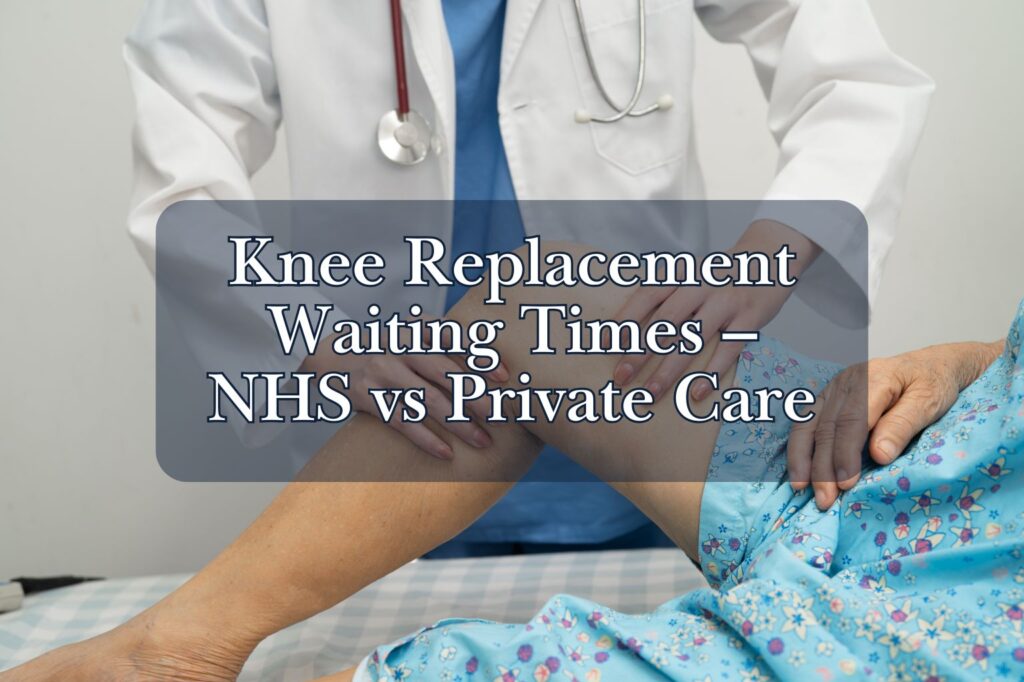 Knee Replacement Waiting Times – NHS vs Private Care